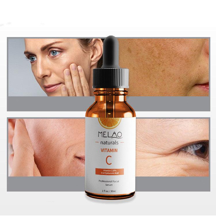 Anti-wrinkle Vitamin C Serum - Nioor