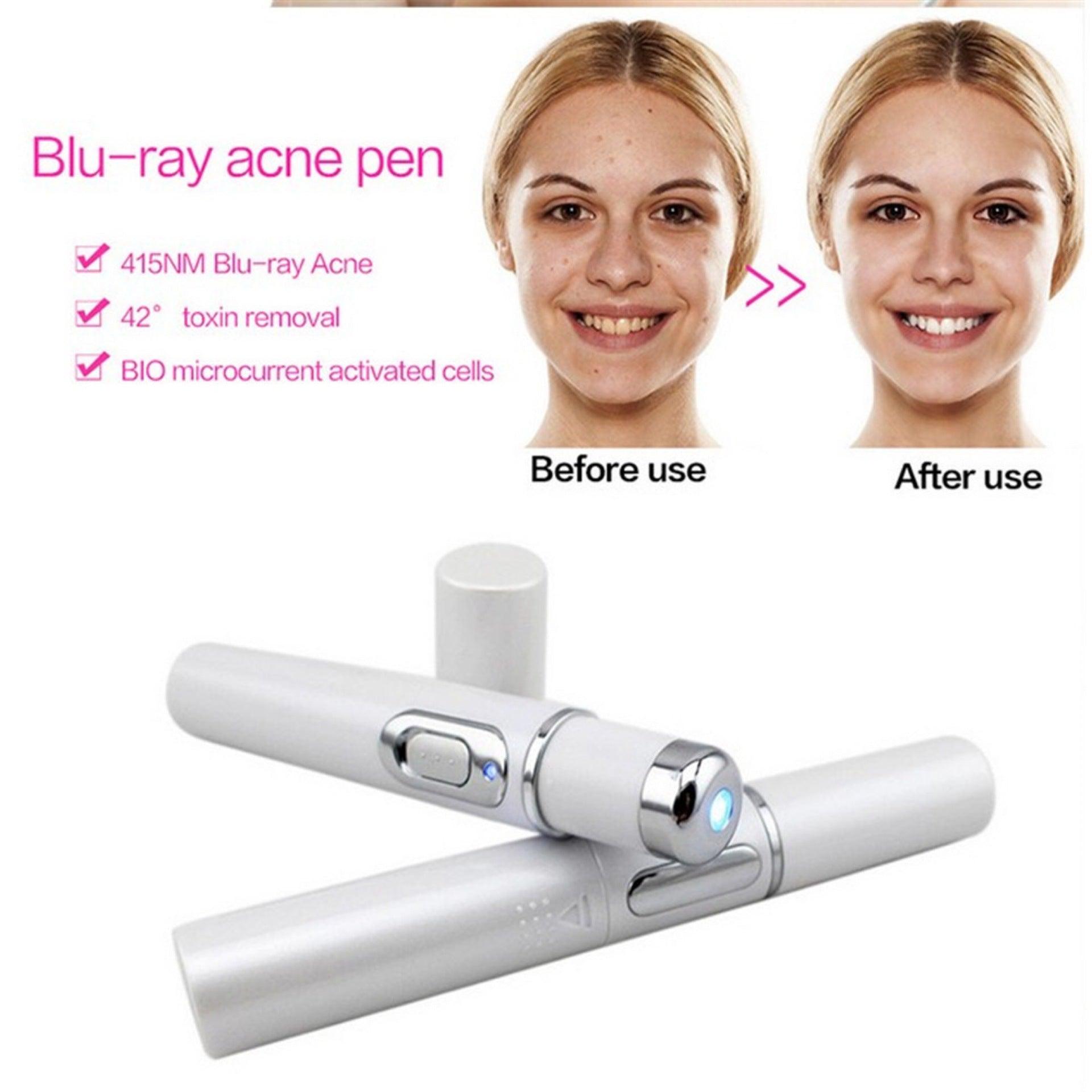 Blue Light Therapy Acne Laser Pen Soft Scar Wrinkle Removal Treatment Device Skin Care Beauty Equipment - Nioor