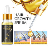 Damaged Hair Repair Women Men's Fast Hair Growth Essence Oil Anti-hair Loss Lotion - Nioor