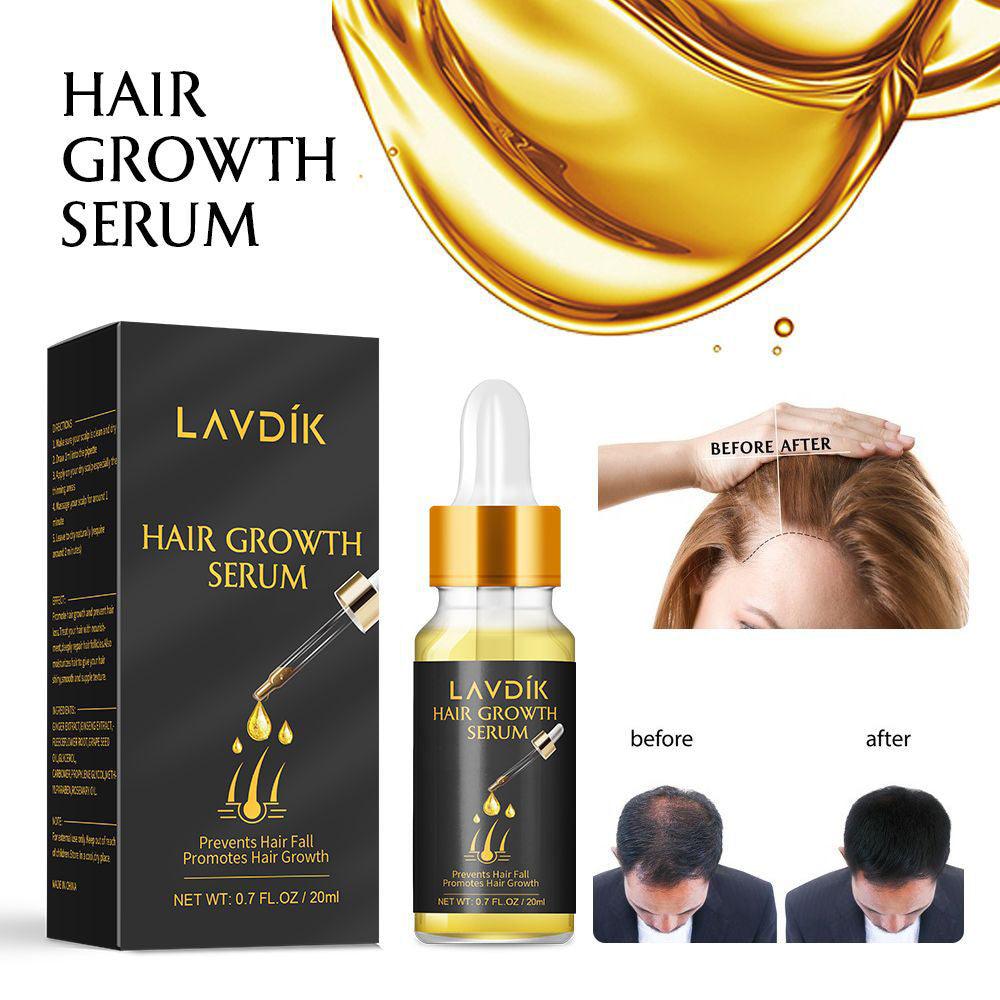 Damaged Hair Repair Women Men's Fast Hair Growth Essence Oil Anti-hair Loss Lotion - Nioor