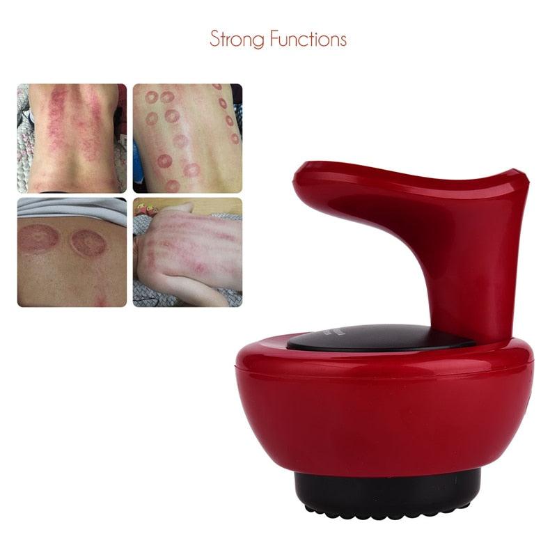 Electric Body Scraping Massager Negative Pressure Cupping Machine Meridian Suction Massage Magnetic Therapy Device - Nioor