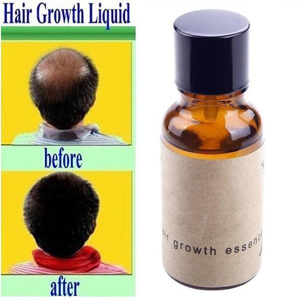 Hair growth liquid - Nioor