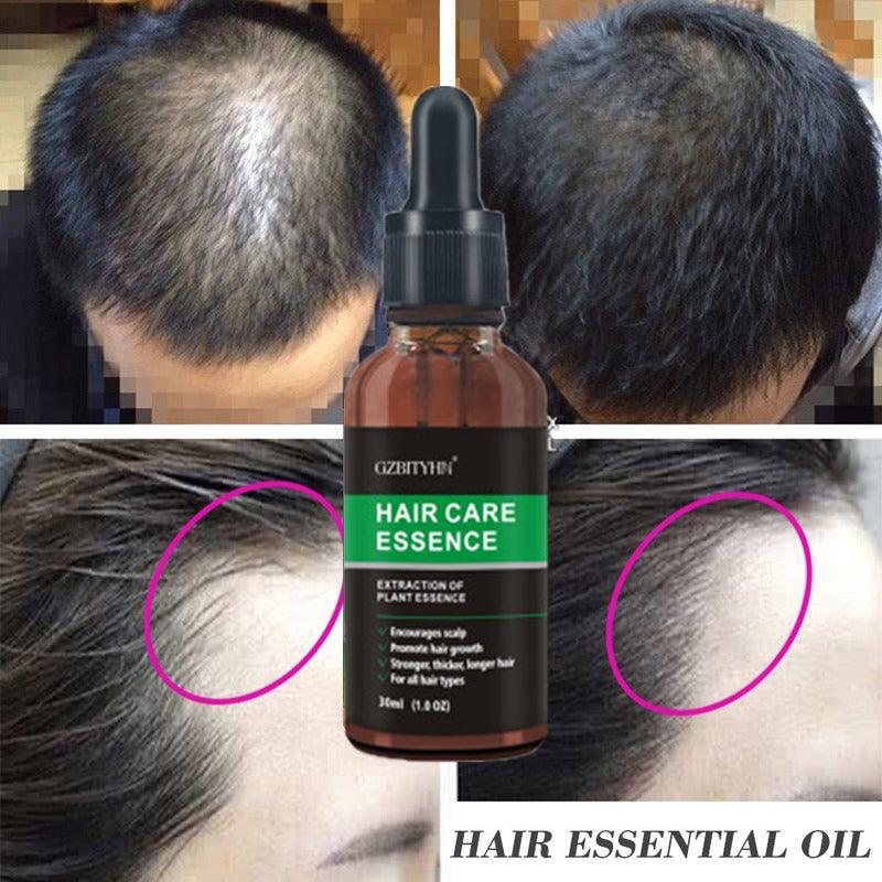 Hair Growth Oil Hair Growth Oil Oem Hair Care Essential Oil - Nioor