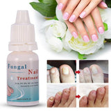 Moisturizing nail liquid 10ml gray nail repair liquid nourishing armor armor sterilization product - Nioor