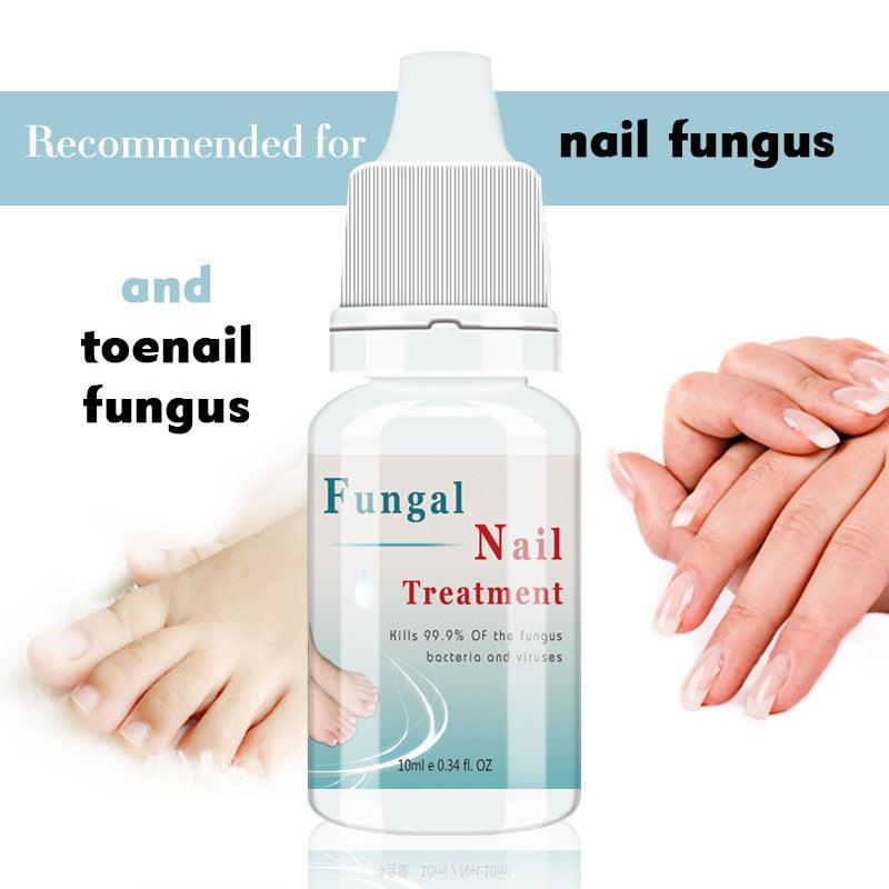 Moisturizing nail liquid 10ml gray nail repair liquid nourishing armor armor sterilization product - Nioor