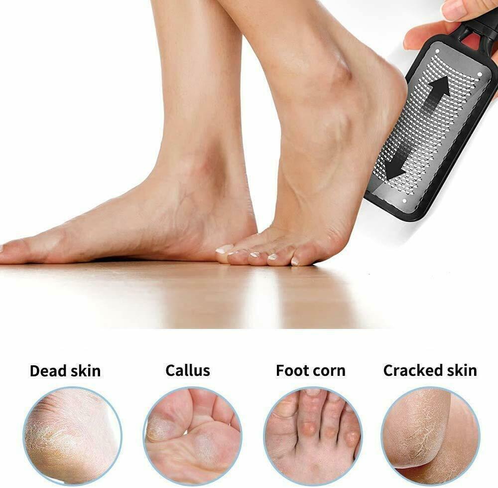 Professional Foot Callus Remover File Rasp Scraper Cracked Pedicure Rough Tool - Nioor