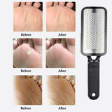 Professional Foot Callus Remover File Rasp Scraper Cracked Pedicure Rough Tool - Nioor