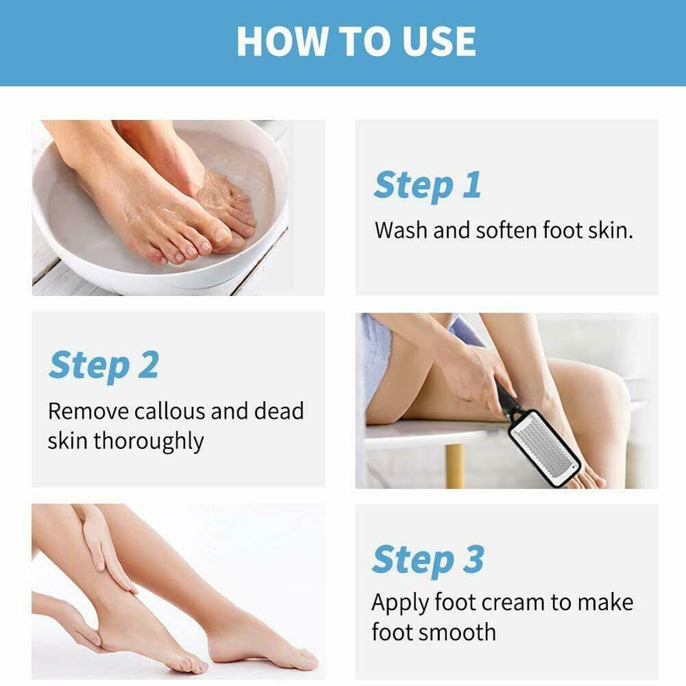 Professional Foot Callus Remover File Rasp Scraper Cracked Pedicure Rough Tool - Nioor