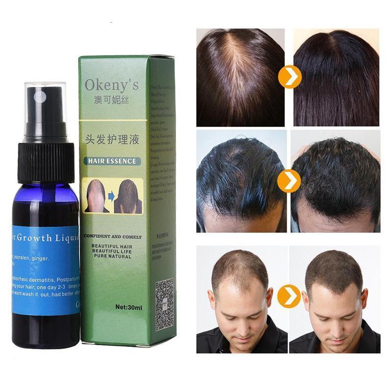 Sunburst Hair Growth Products for women&men anti hair loss products Alopecia Baldness beard oil growth Hair growth spray - Nioor