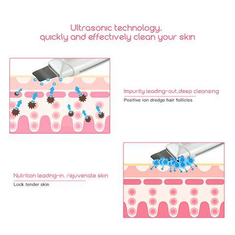 Ultrasonic Skin Scrubber Face Cleanser Blackhead Acne Removal Facial Spa Vibration Massager Ultrasound Peeling Clean Machine 394 - Nioor