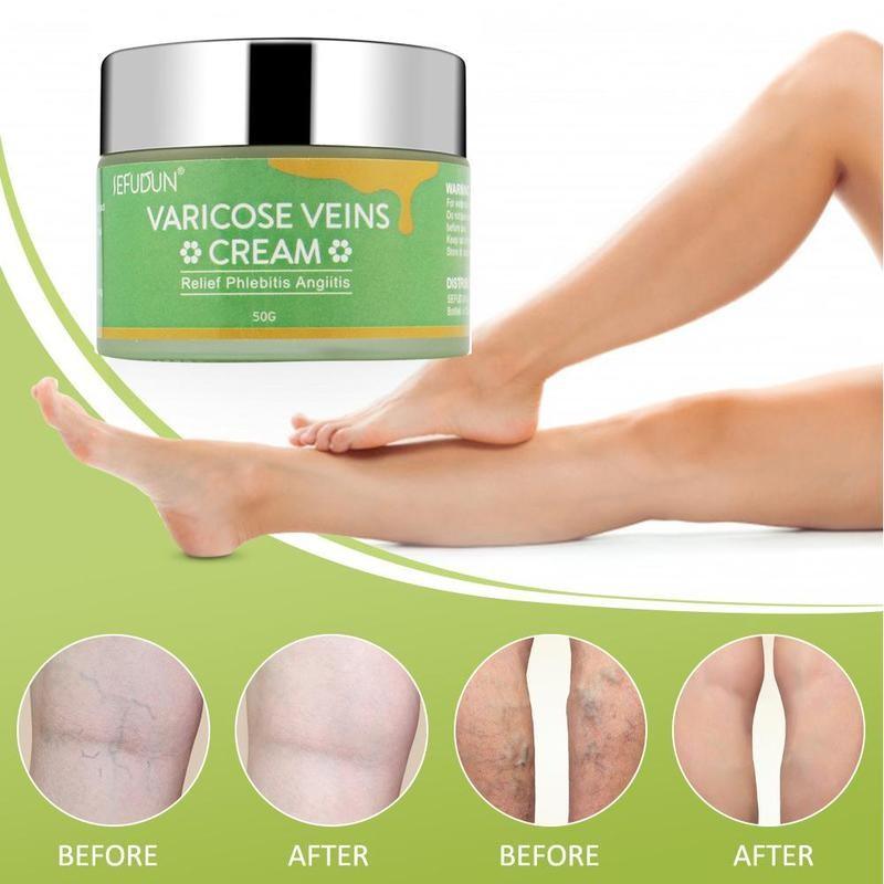 Vein Cream Red Blood Streaks Repair Earthworm Leg Bruises Bulge Relief Pain Safflower Ointment Varicose Cream - Nioor